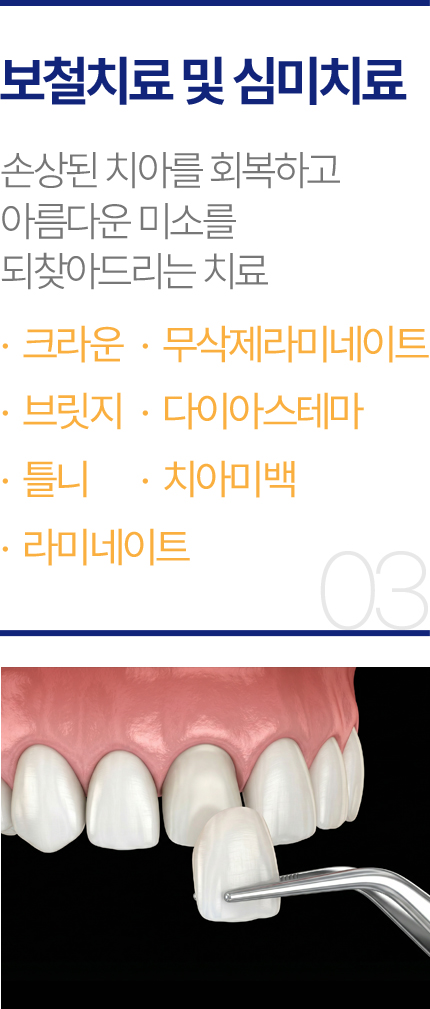 보철치료 및 심미치료