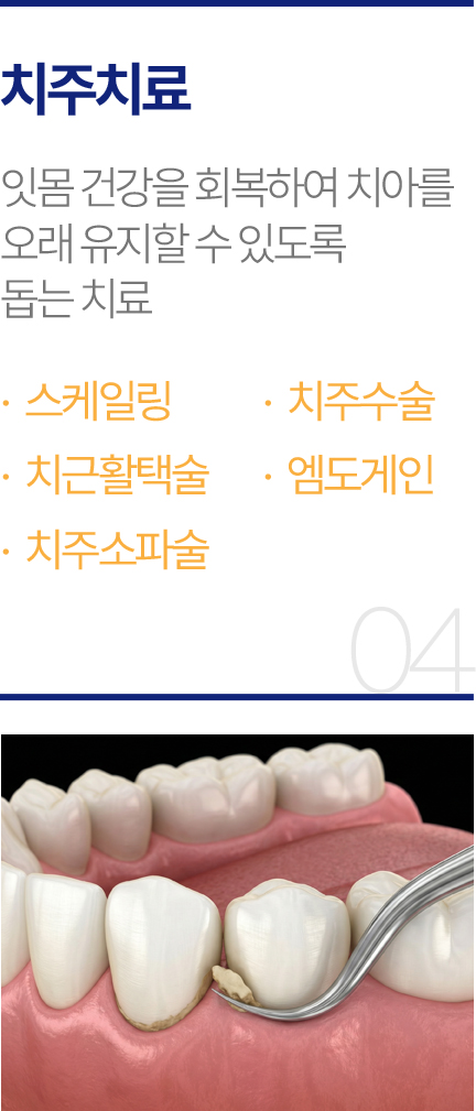 치주치료