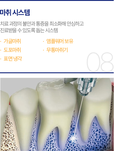 마취 시스템